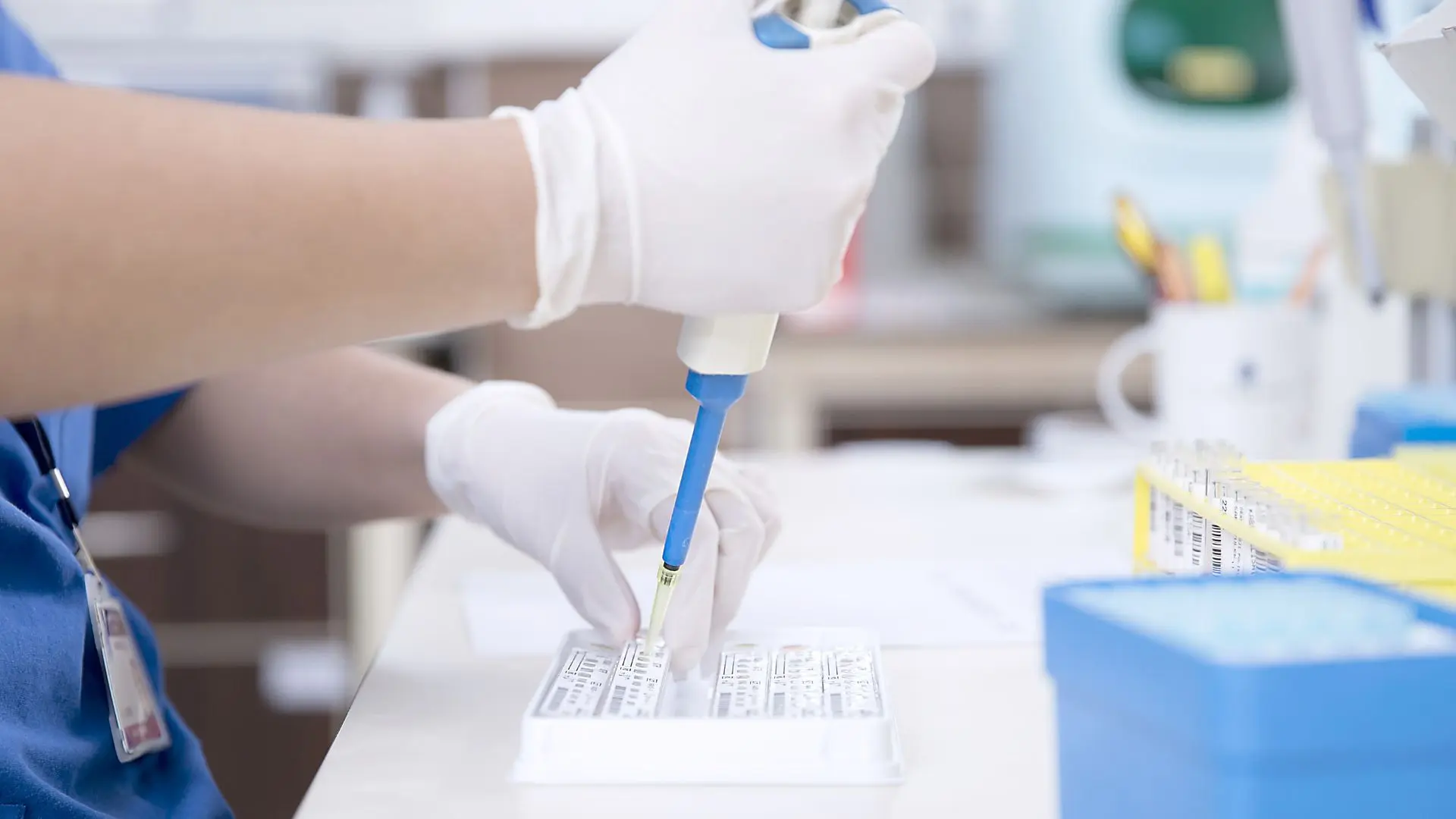 Veterinario fa le analisi del sangue per FIP